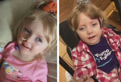Young girl who was diagnosed with epilepsy pictured smiling 