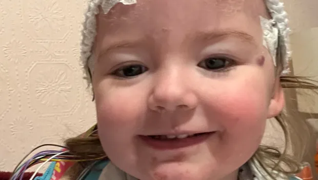 Young girl with electrodes on her head ready for an EEG scan.